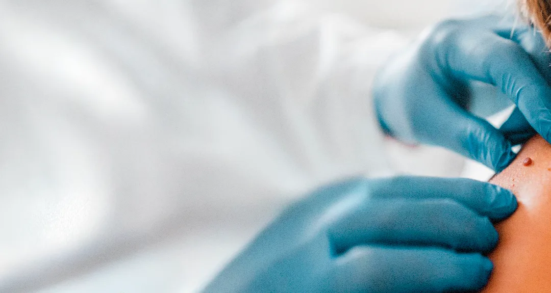 Projeto Retrate: como a prevenção tem impactado vidas!