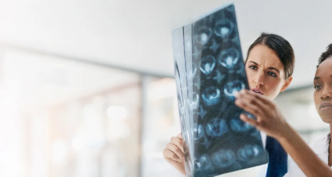 Quando um tumor é câncer? Entenda as diferenças e os tratamentos